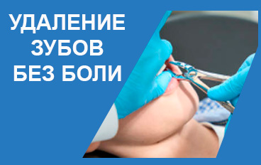 УДАЛИТЬ ЗУБ БЕЗ БОЛИ САО РЕЧНОЙ